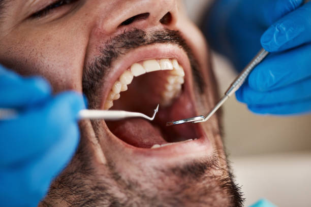 Oral Surgery in Vista Center, NJ